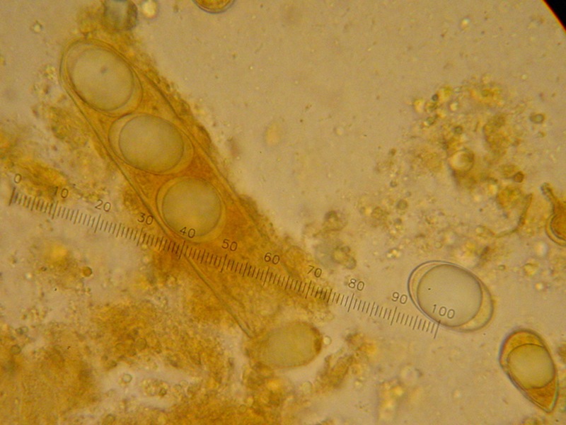 Un ascomicete poco comune: Helvella silvicola