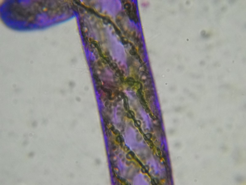 Spirogyra sp.