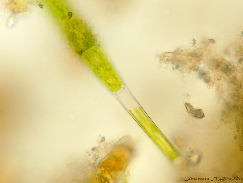 cloroplasti di Oedogonium