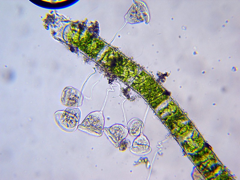 Vorticella sp. (forse similis)