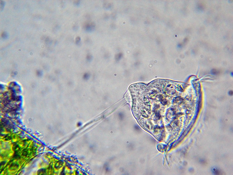 Vorticella sp. (forse similis)