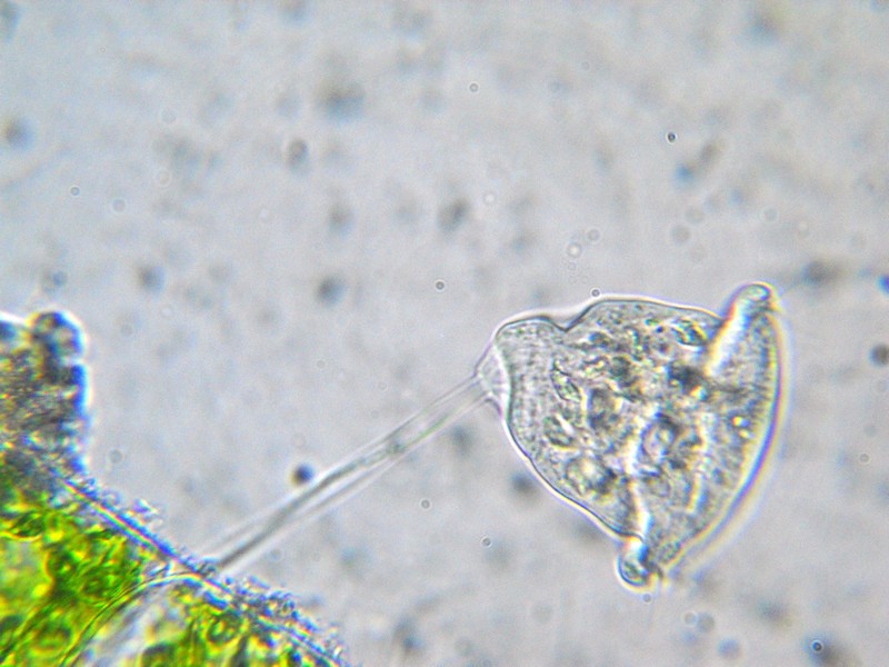 Vorticella sp. (forse similis)