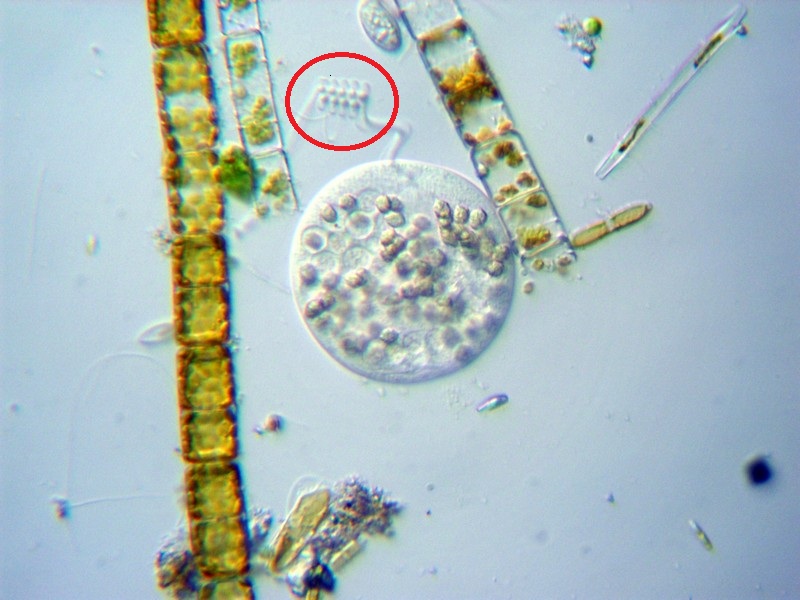 Vorticella obesa