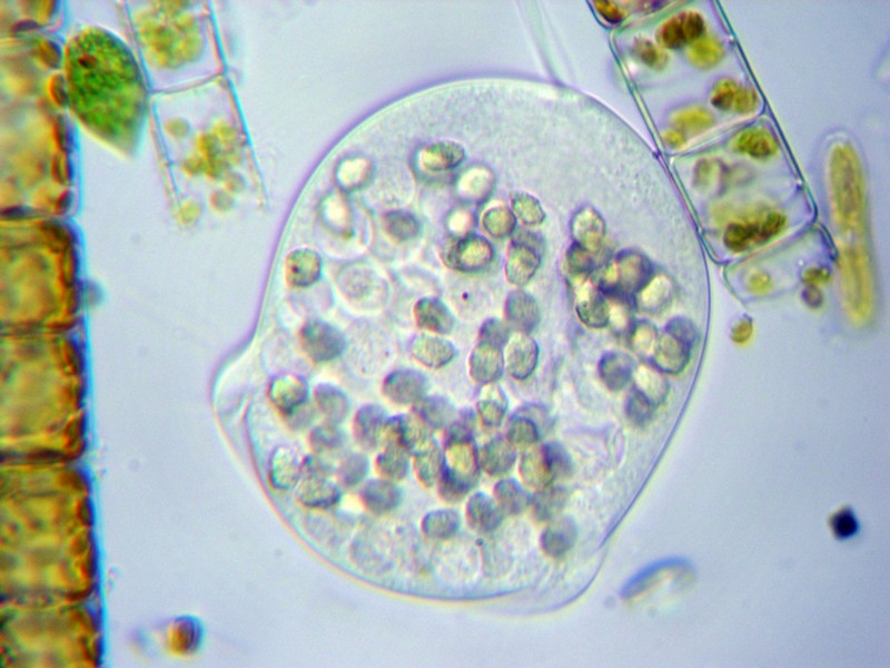 Vorticella obesa