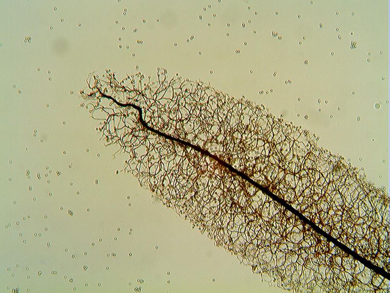 Stemonitopsis hyperopta