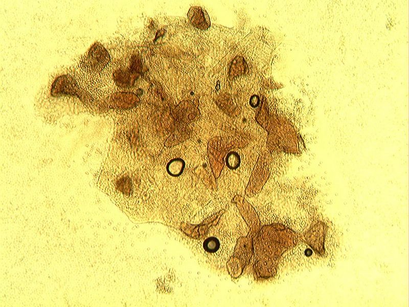 Lycogala exiguum