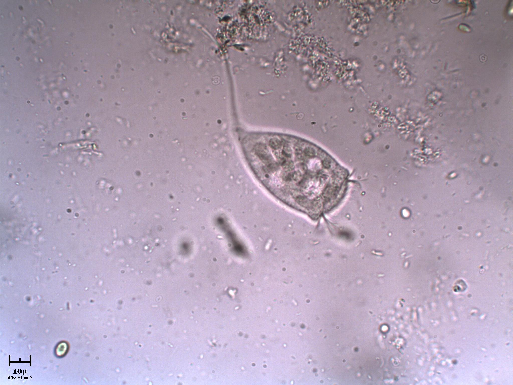 Vorticella