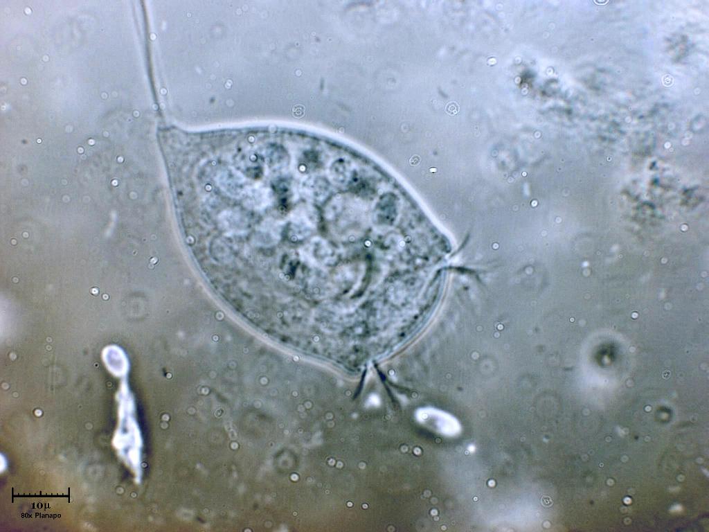 Vorticella