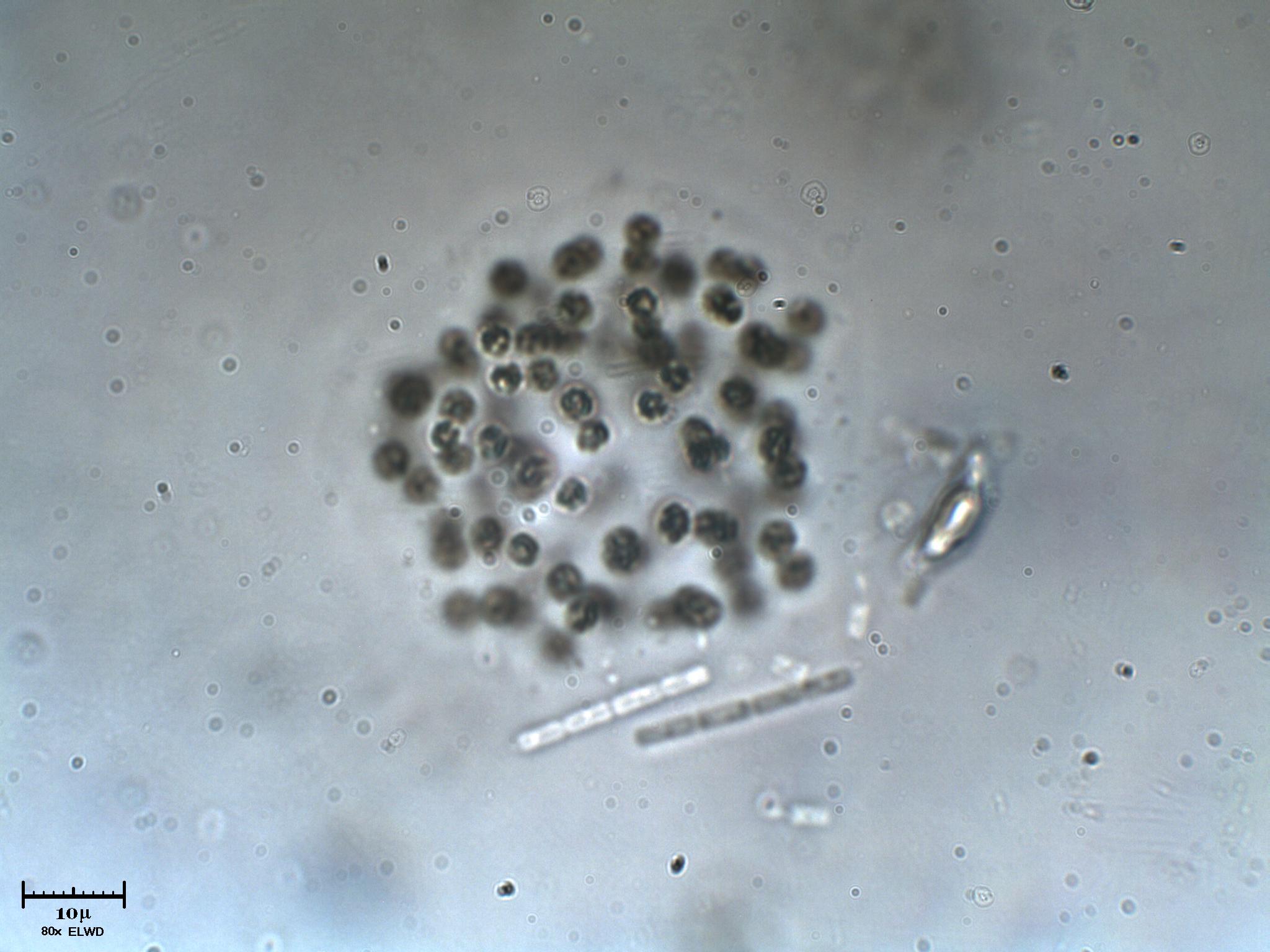 Microcloroficee (o cianobatteri?)