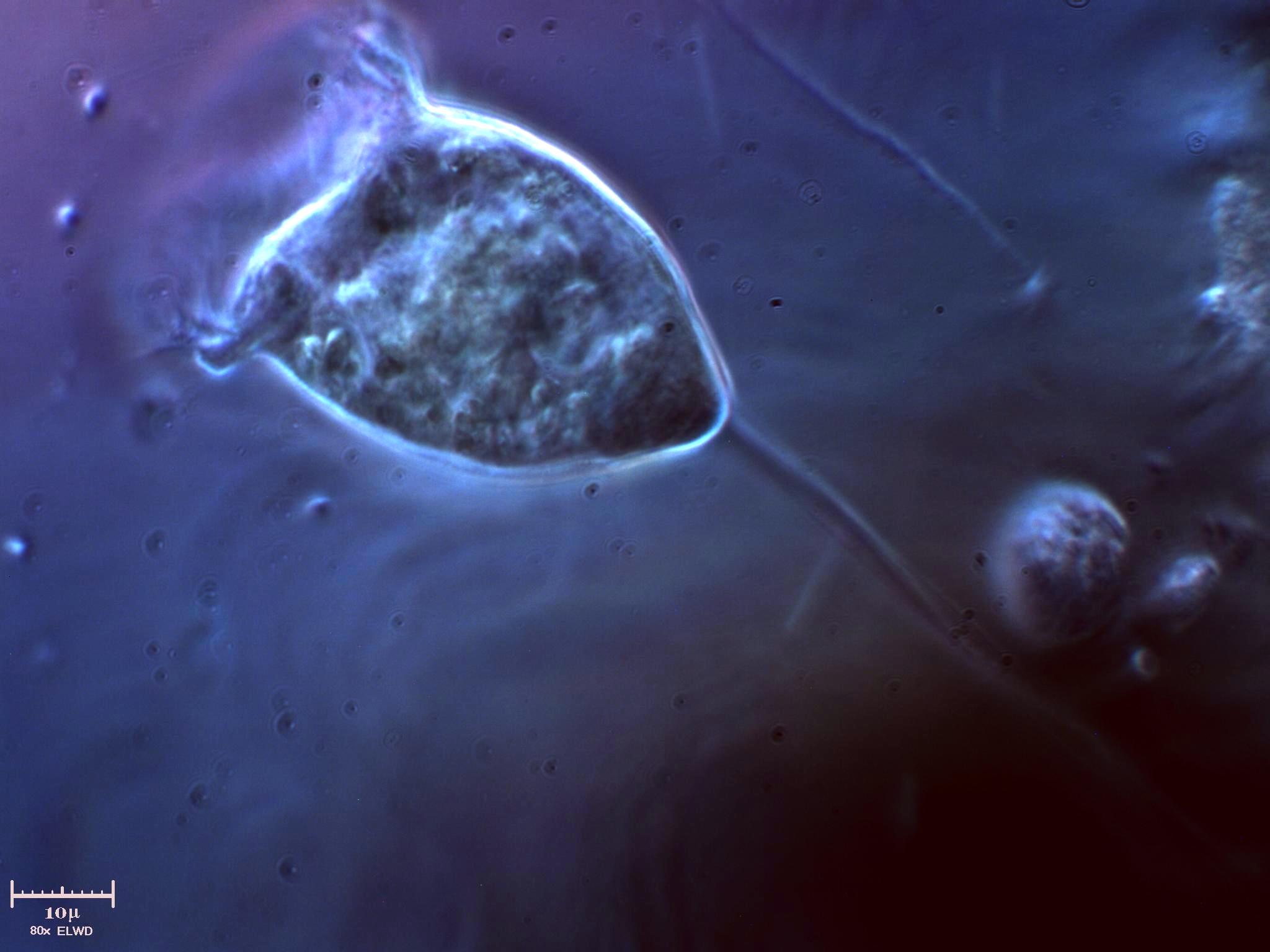 Vorticella