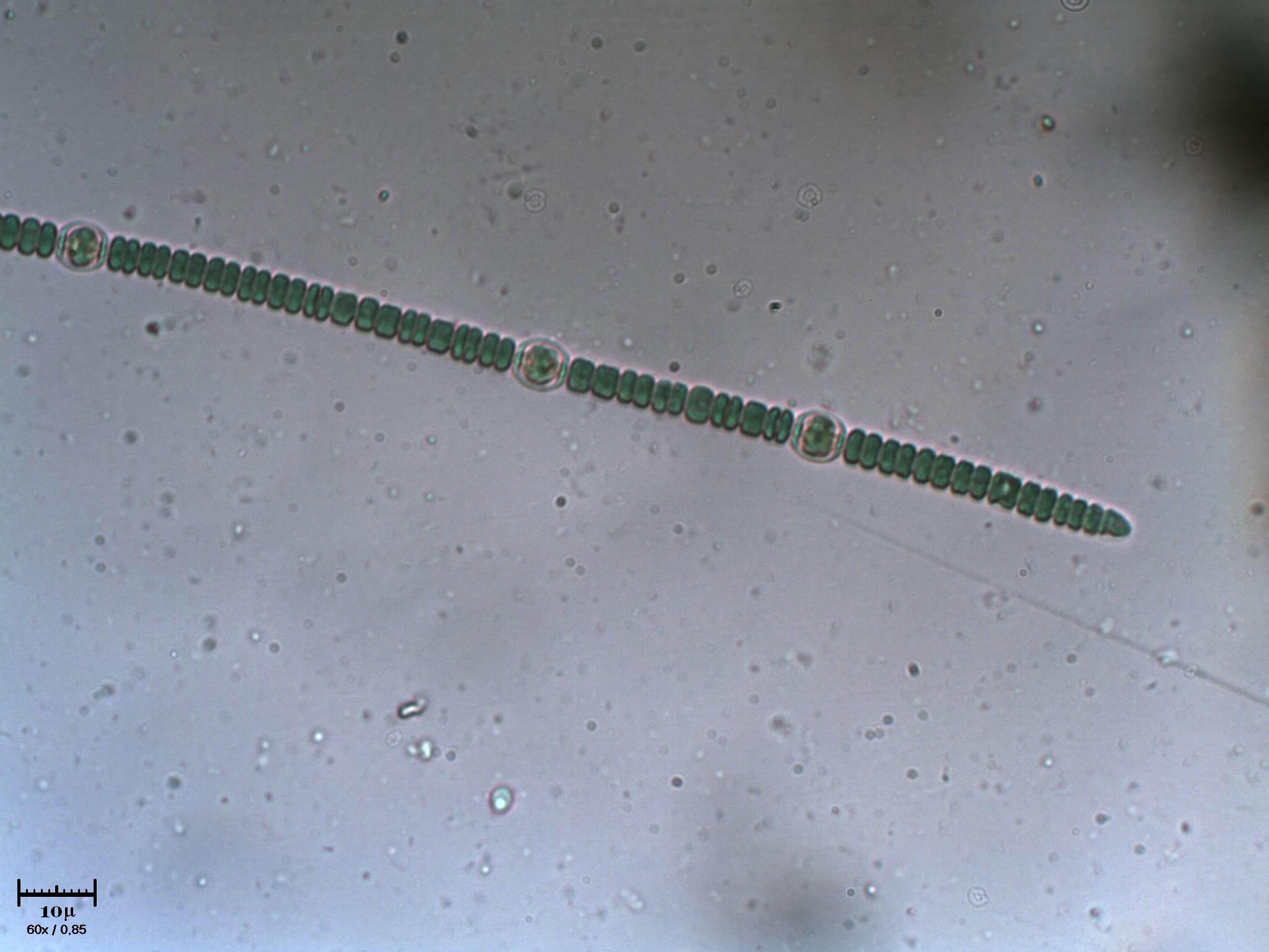 Anabaena