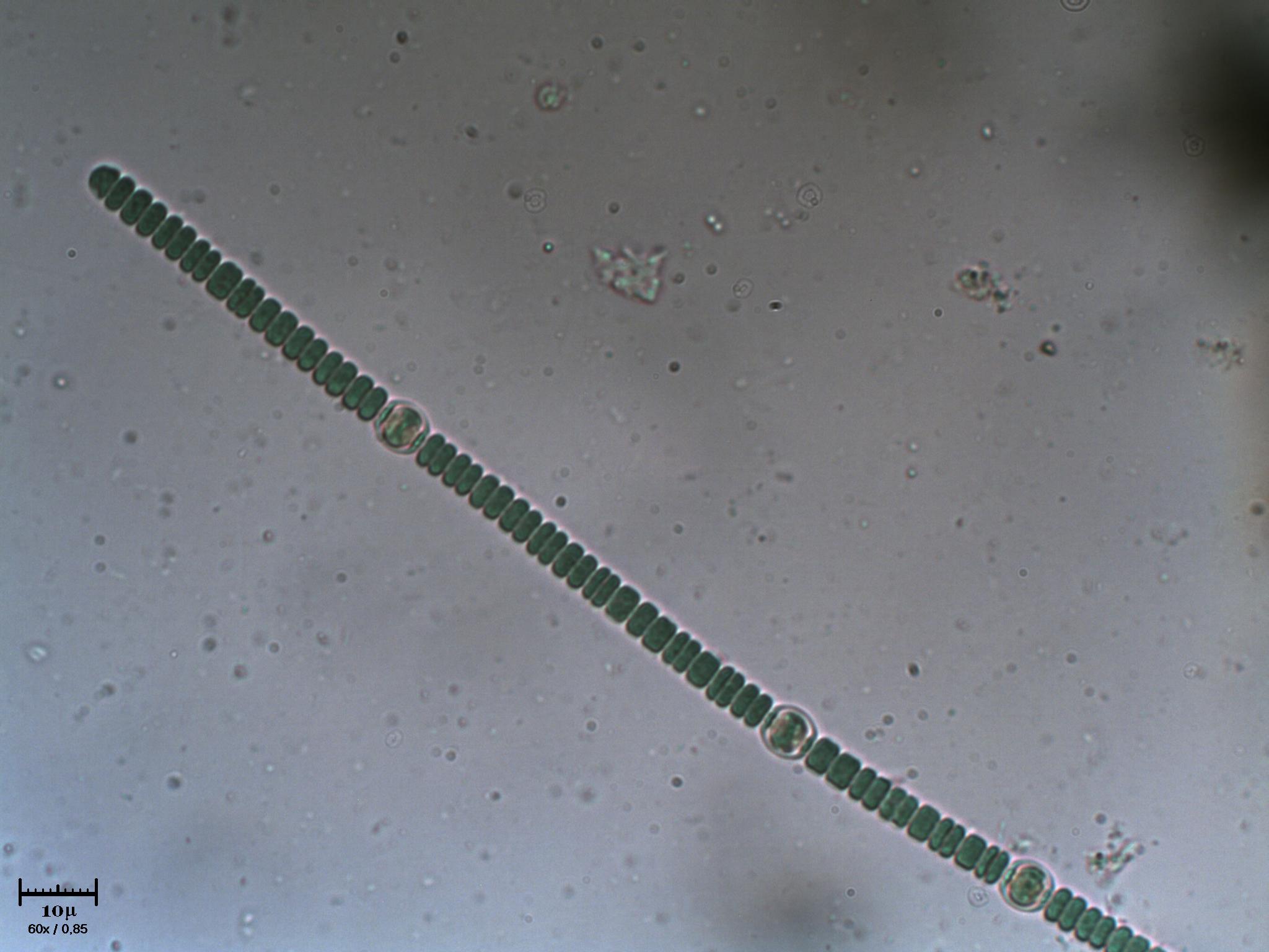 Anabaena