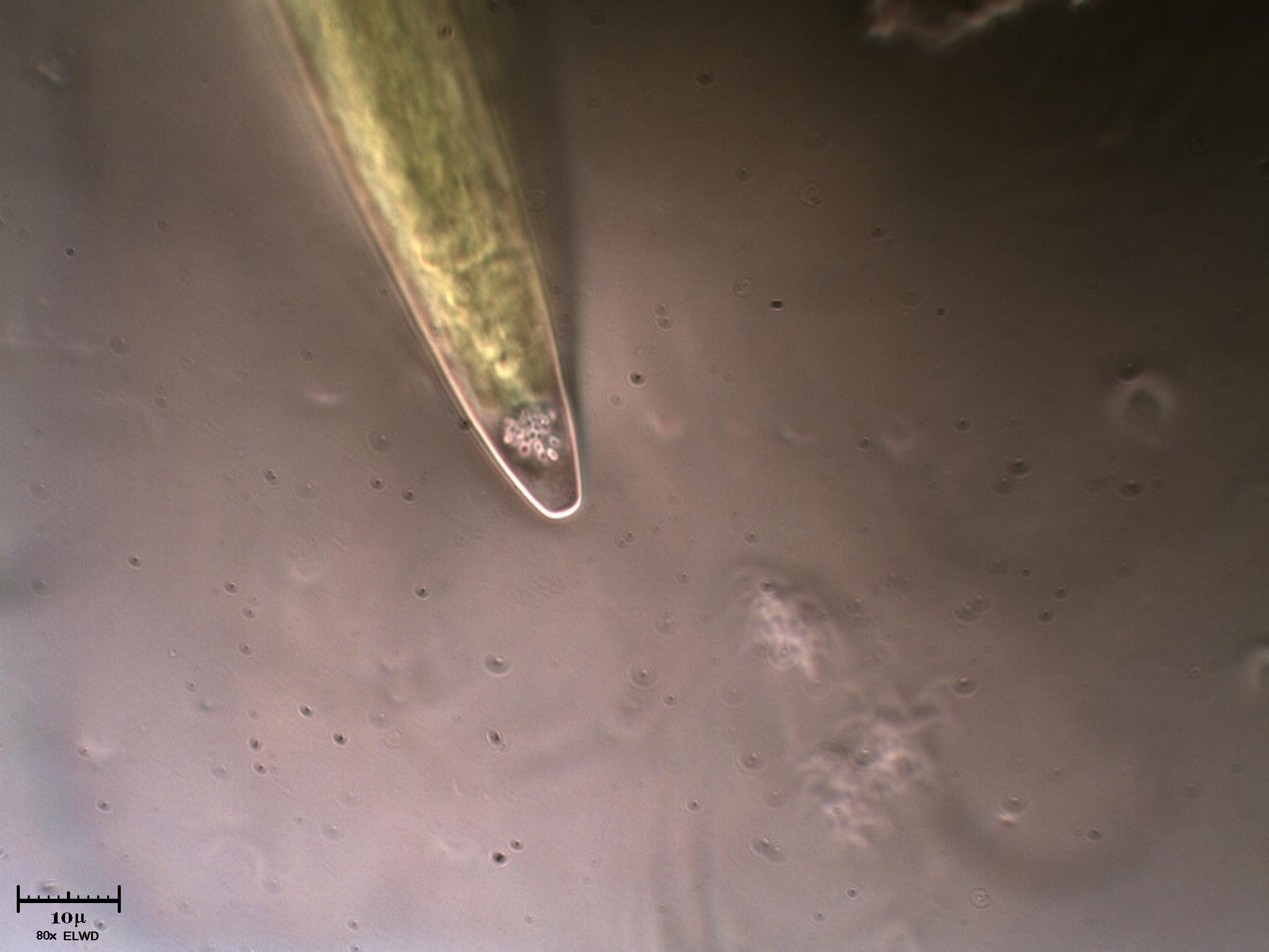 Closterium mesosaprobionte