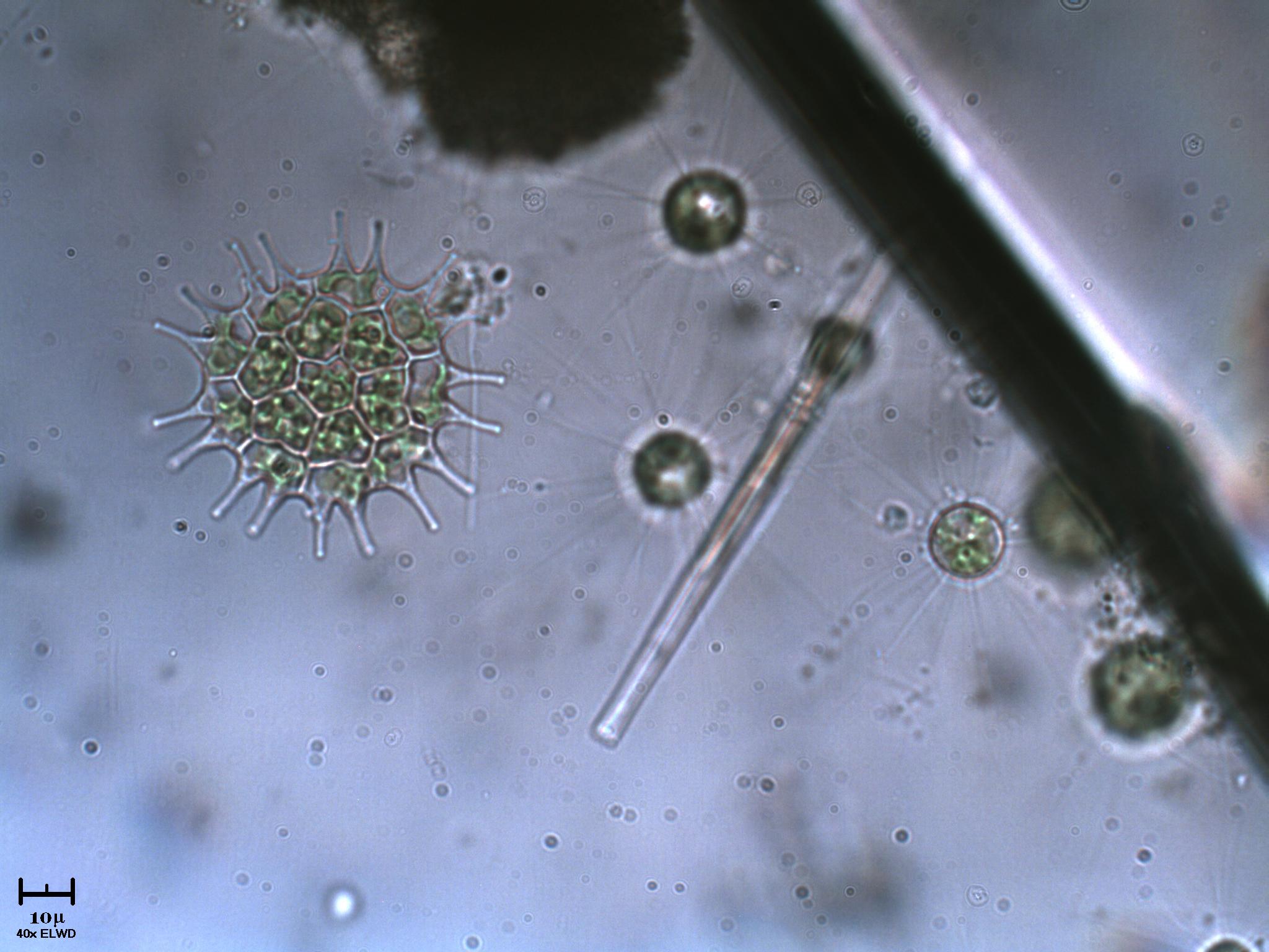 Pediastrum. Golenkinie & Diatomea acus