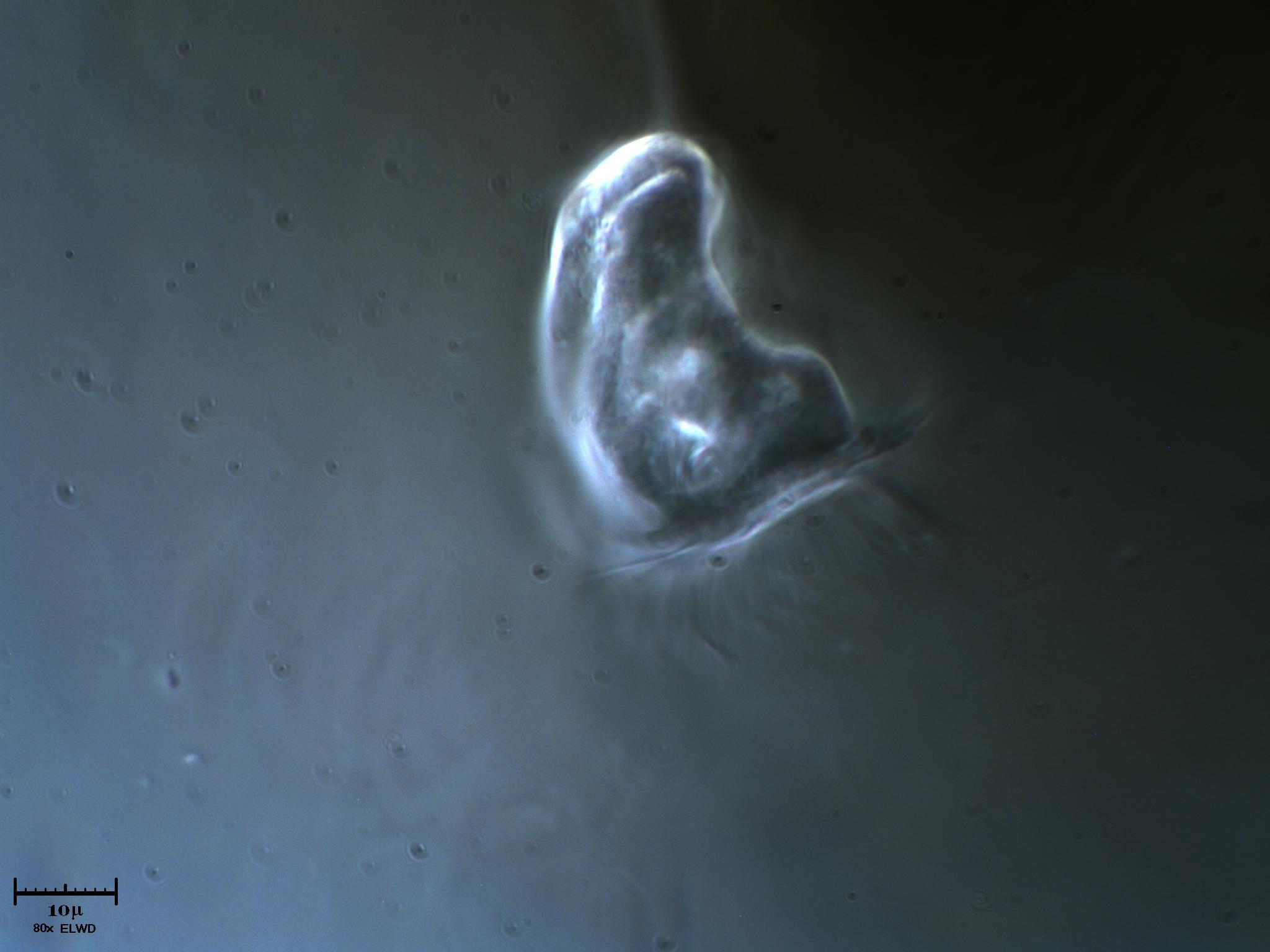 Vorticella