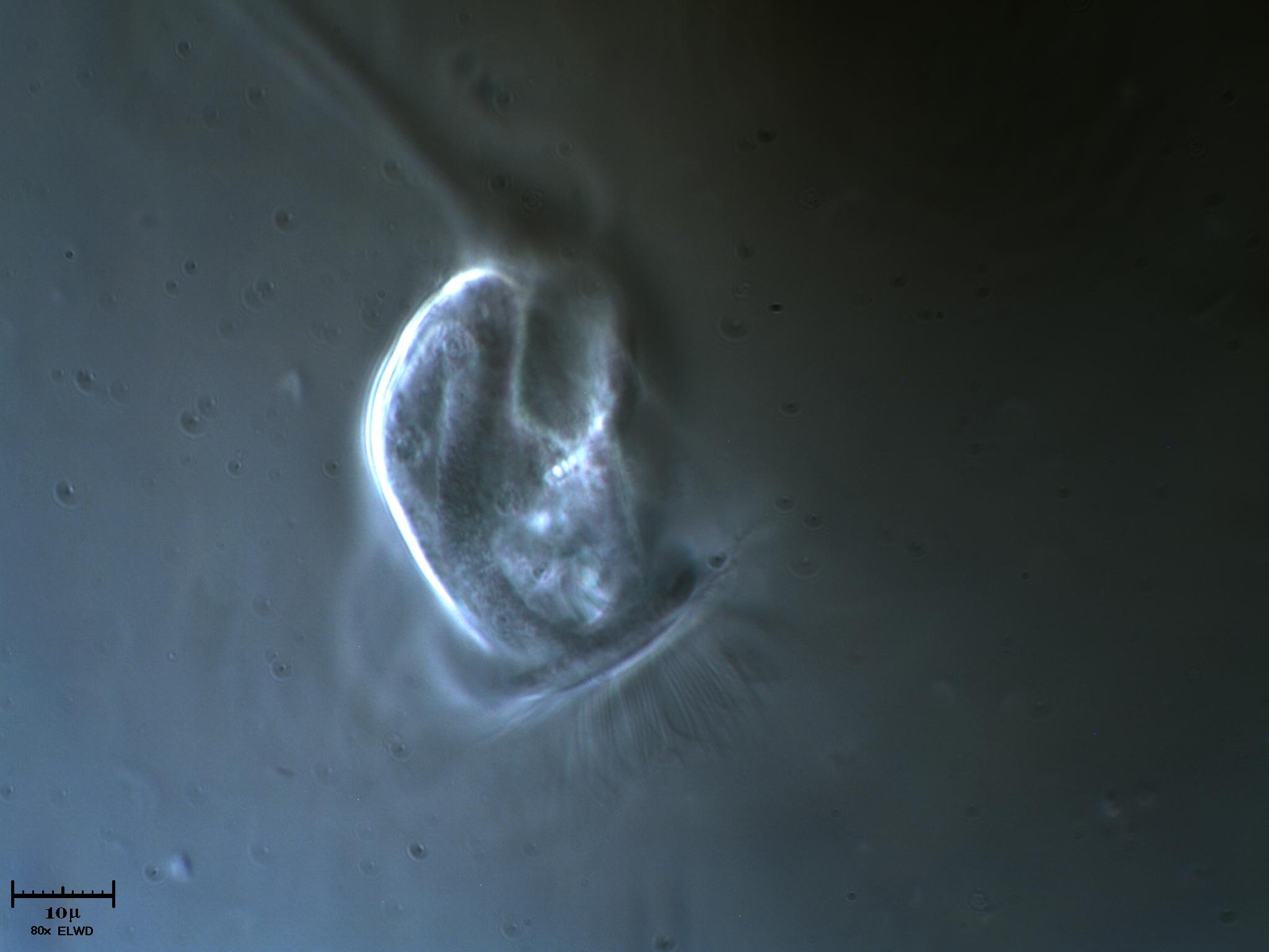 Vorticella