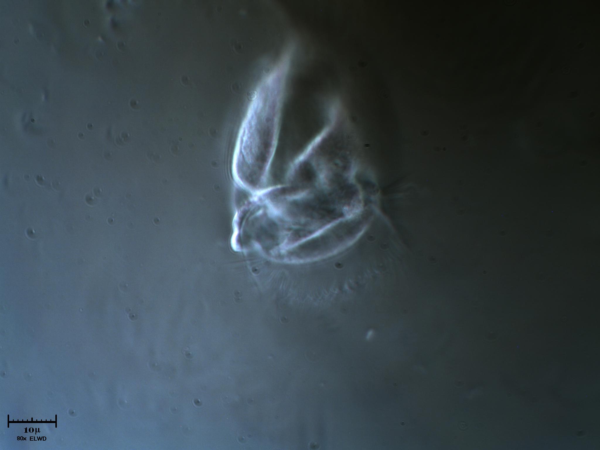 Vorticella