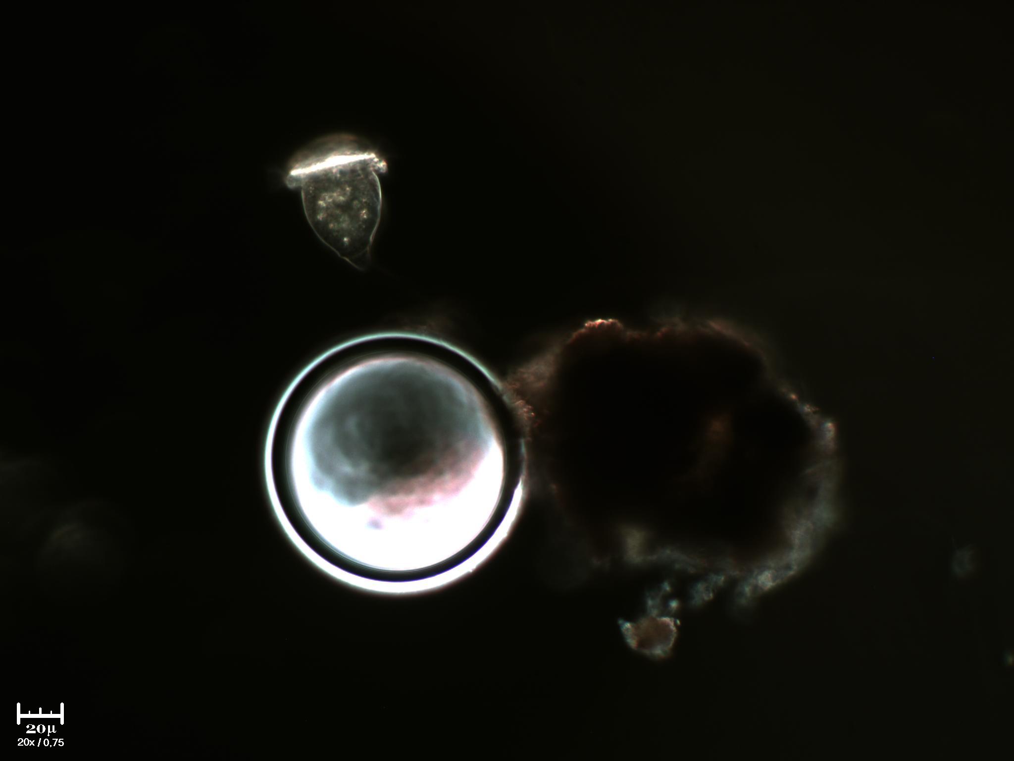 Vorticella