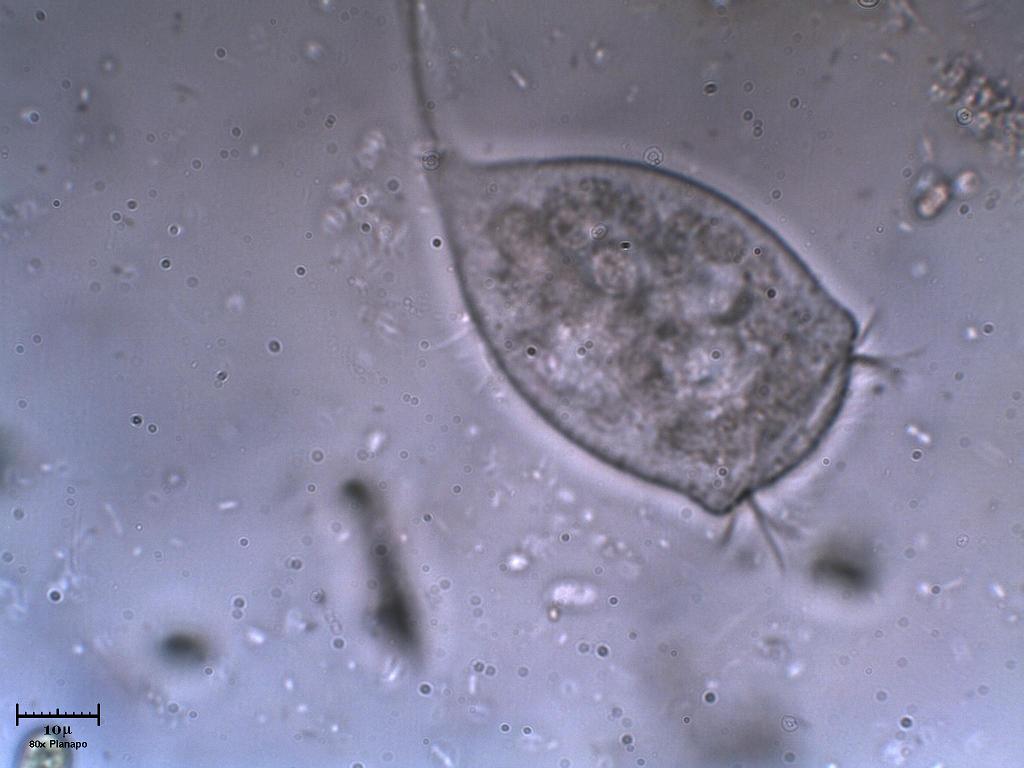 Vorticella