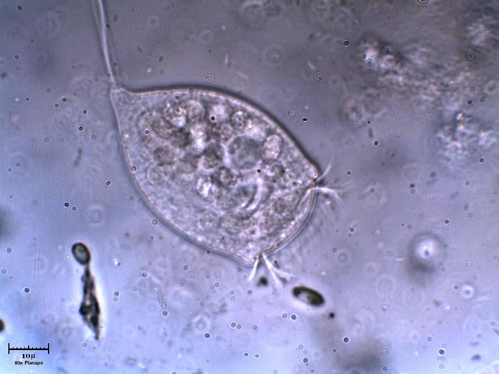 Vorticella