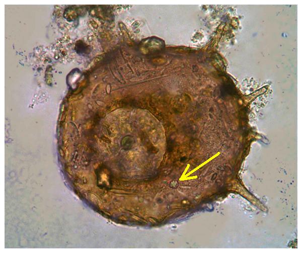 Quiz: Centropyxis aculeata