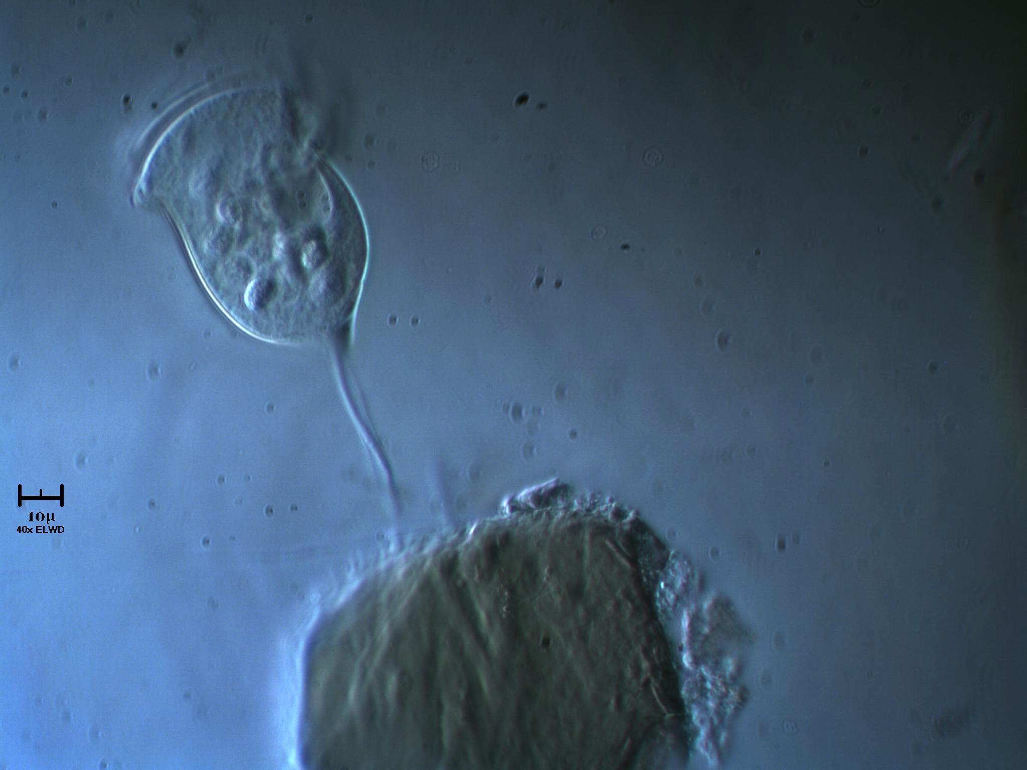 Vorticella