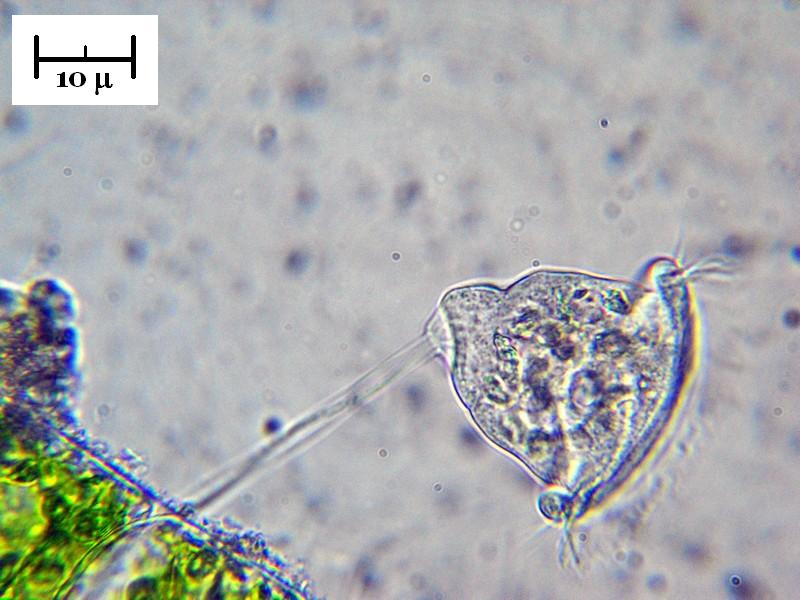 Vorticella sp. (forse similis)