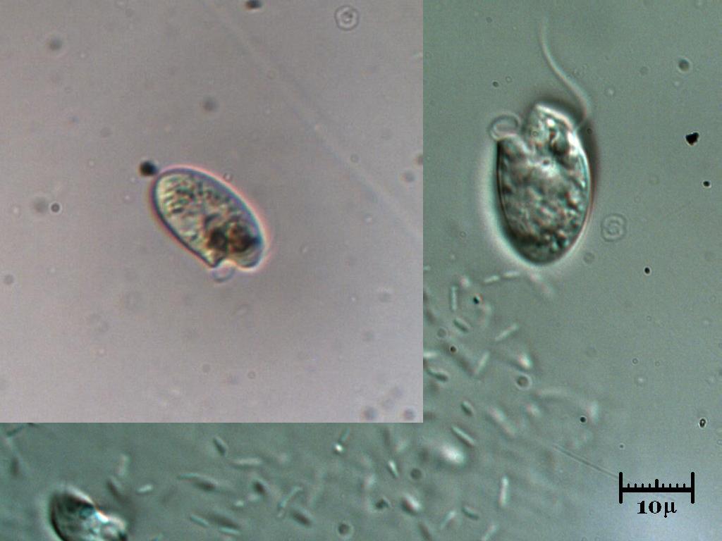 Oxyrrhis marina, dinoflagellato marino