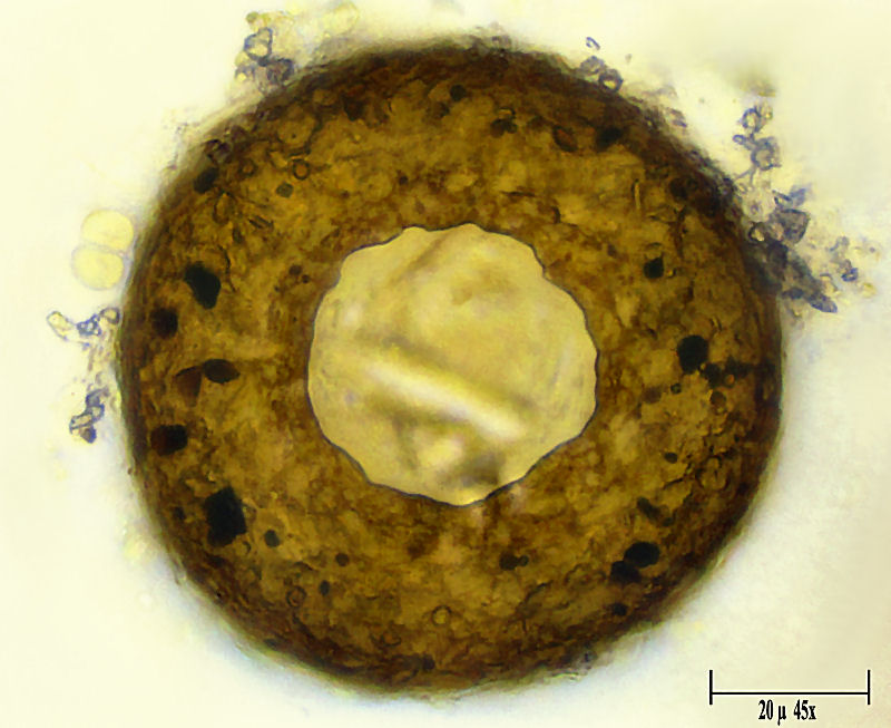Difflugia globulosa