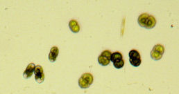 Stenostomum