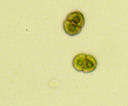 Stenostomum