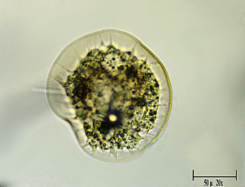 Tecameba quasi trasparente - cos'' ? [Arcella sp.]