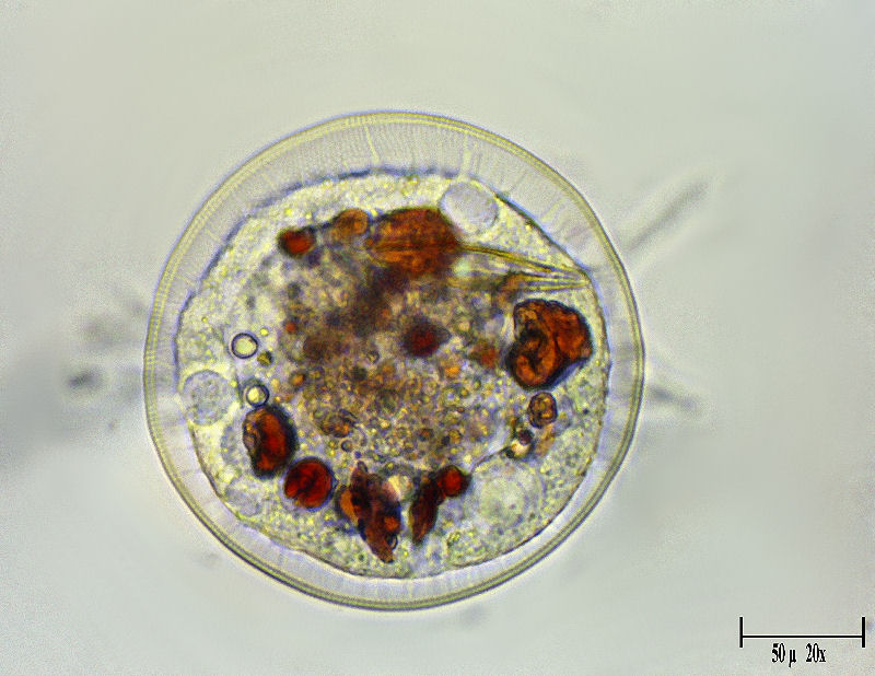 Tecameba quasi trasparente - cos'' ? [Arcella sp.]