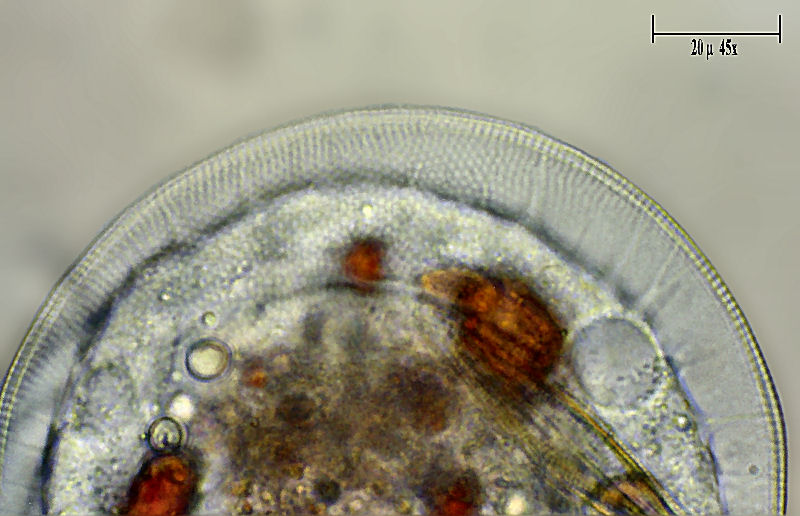 Tecameba quasi trasparente - cos'' ? [Arcella sp.]