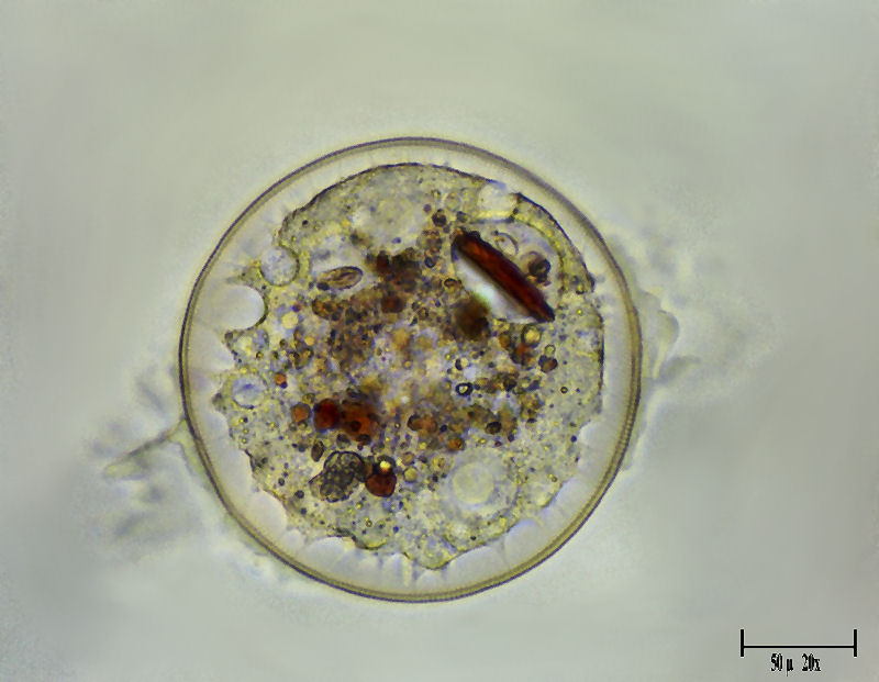 Tecameba quasi trasparente - cos'' ? [Arcella sp.]