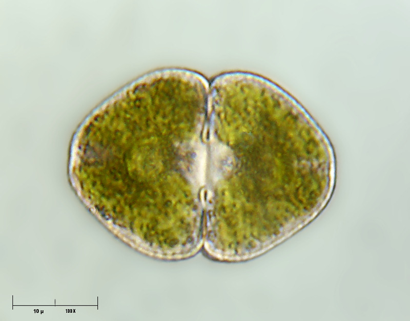 Cosmarium sp.