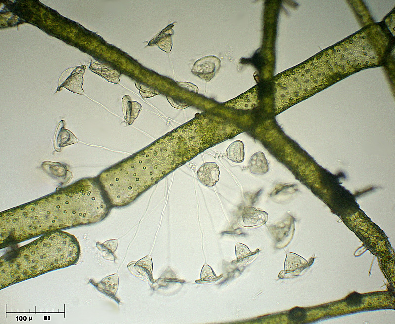 Vorticella campanula