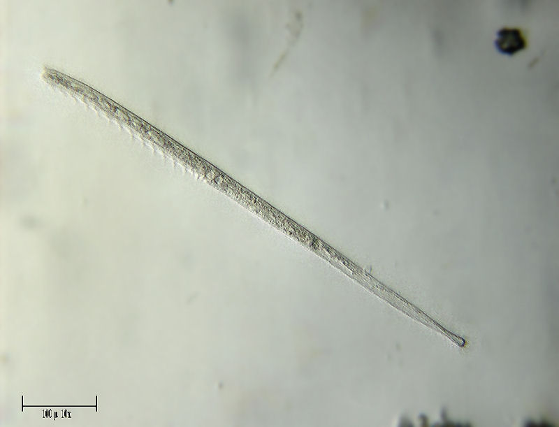 Spirostomum minus