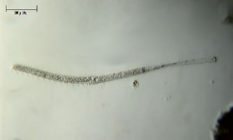 Spirostomum minus