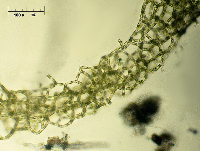 baby   Hydrodictyon reticulatum