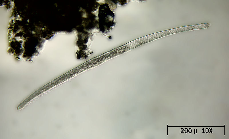 Spirostomum ambiguum