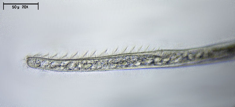 Spirostomum minus