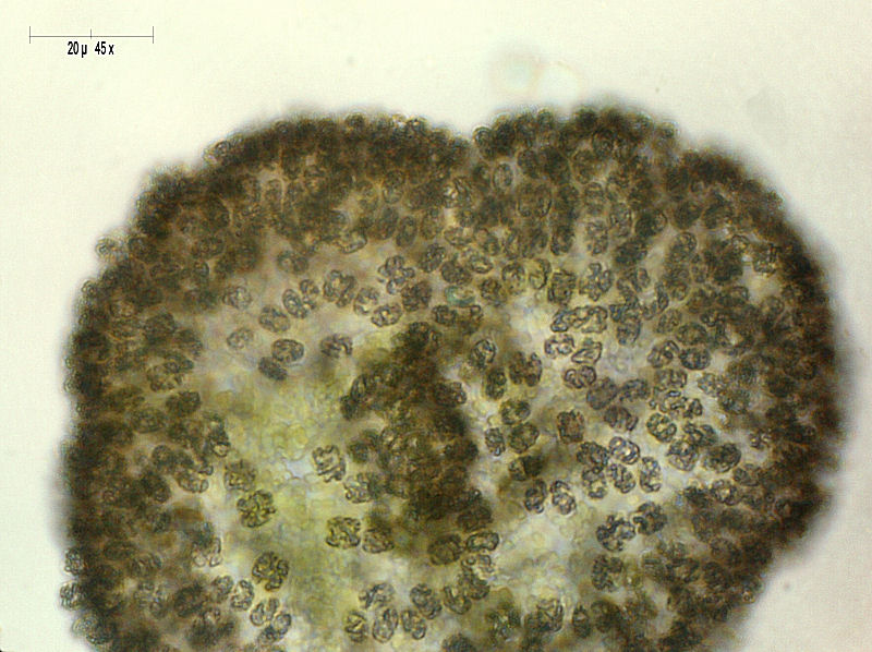 Microcystis sp.