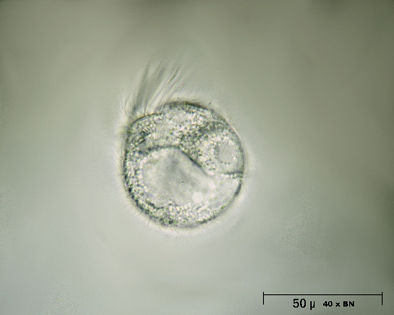 Halteria sp. o Strobilidium sp. ? [ Askenasia sp. ]