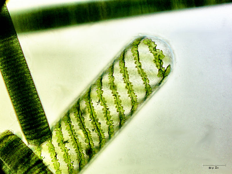 Spirogyra sp.