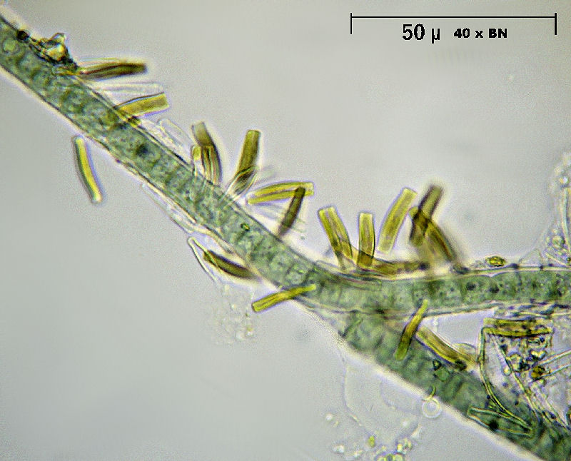 Diatomee su cyanobattero  - Synedra sp. ?
