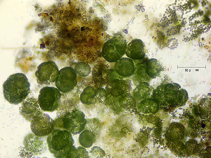 Microcystis sp.