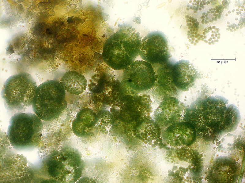 Microcystis sp.