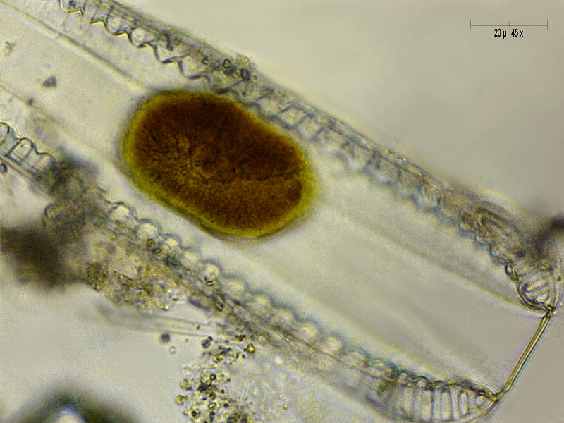 Surirella robusta