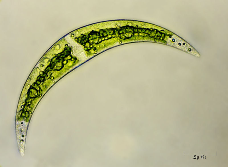 Closterium